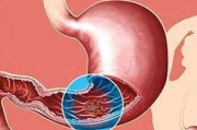 食道癌很隐秘？一旦发现这个信号，多半是食道癌来了