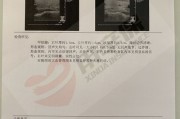 甲状腺结节才一年竟变恶性，什么等级最可怕？医生教你判断