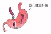 胃怕三件事，再不改，幽门螺旋杆菌可能会把你的胃掏空