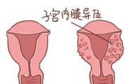 女性子宫病变，身体会有这个表现，很多人都忽视了！