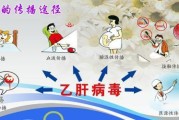 乙肝怎么传染给小孩