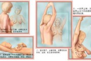 女性患上乳腺癌原因有哪些？如何通过自查法，发现和预防乳腺癌？