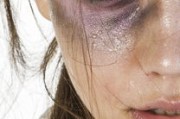 明星整容照背后的故事—揭开美丽背后的真相与思考