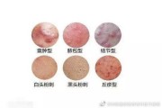科学祛痘指南有效去除痘痘的方法与策略