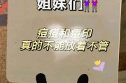 为何在预算允许的情况下，手机运存越大越好？