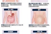 肝癌术后的复发机率大？怎样治能提前预防