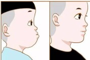 究竟是什么病，让人越长越丑？