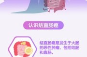 守护肠道健康，远离结直肠癌——世界肠道健康日的预防指南