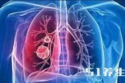 治疗癌症的化学疗法，你到底知道多少