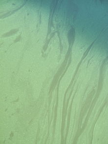 身体的‘清道夫’过氧化物歧化酶如何守护你的健康