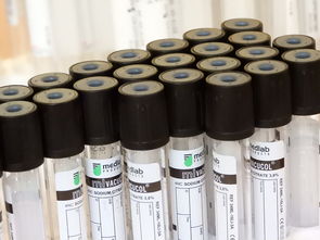 热机械分析仪（TMA）材料科学中的隐形英雄，解读其工作原理与应用场景